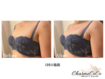 シャルムココ 蔵前店(CharmeCoCo)/お客様Before→After
