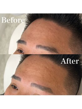 モテテ(motete)/お客様施術例☆栄本店