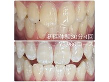 ホワイトニングルーム 横浜店(Whitening Room)/セルフホワイトニング/横浜