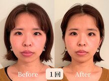 ロシュニ/30代 お悩み:顔の余白