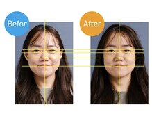 アオバダイ整体院/整体/小顔矯正/自律神経