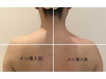 イーズ ららぽーと湘南平塚店(E/S)/