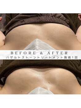 マタタビ(mata-tabi)/ウエディングでもそうでなくても