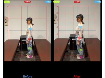 ケアハウス センター南(CARE HOUSE)/施術効果写真☆(before after)