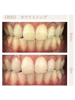 サロンドプラス(Salon de Plus)/