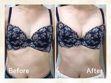 トータル ビューティー サロン レムリア(Lemurian)/◇バストパレット◇