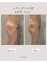 なごみ/脂肪分解【レモンボトル】