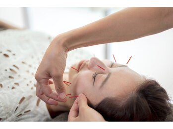 コンフィアンス シンバ(Confiance Simba)