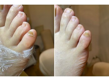 ココン フワット(cocon fouato)/ネイルケアbefore・after　銀座