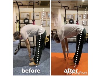 カワル整体 上通り院/反り腰の方はすぐやめてください