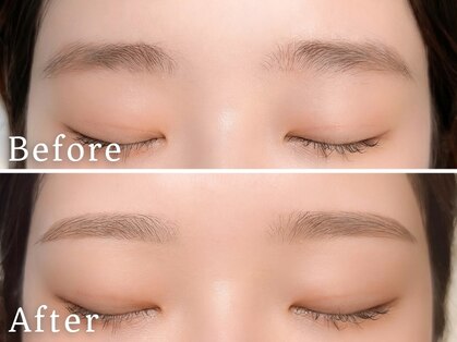 ビューティジーン プロフェッショナル 天神店(BEAUTY GENE professional)の写真