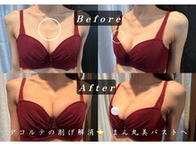 エステティックサロン パヒューム(Esthetic Salon Perfume)/ぱーんとハリのある美バストへ♪