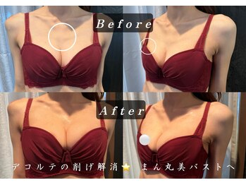 エステティックサロン パヒューム(Esthetic Salon Perfume)/ぱーんとハリのある美バストへ♪