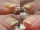 爪育ネイルケア
