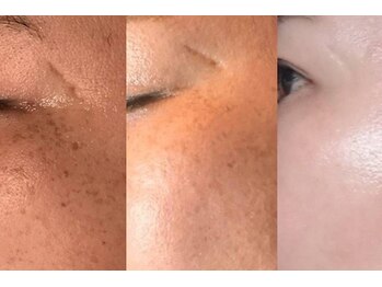 エミニナル(EMININAL)の写真/そのくすみ、本当に年齢のせいですか？肌から透明感を作る本格ケア