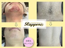 ラポール(rappore;)