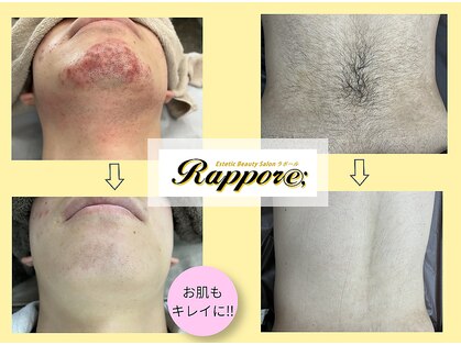 ラポール(rappore;)の写真