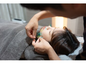 ヴィーライン 新横浜院(VeLine)/形状記憶美容鍼のご説明