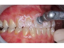 エクシアホワイトニング 日本橋店/PMTC