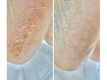 ラヴィ(La vie)/靴下履いているときも…