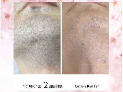 ココスターリー(Coco starry)の写真