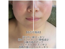 ココオーブ(COCO AUBE)の雰囲気（巻き肩肋骨矯正+ドライヘッドで【リフト小顔矯正】スタート）