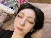 アールアンドエス(R&S)/プラズマフェイシャル