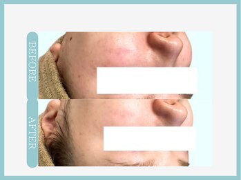 スリムライン 仙台店(The Slim Line)/before→after