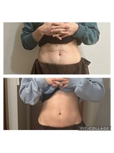 絢香/ビフォーアフター！