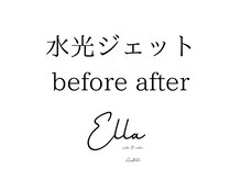 エラ(ella)/