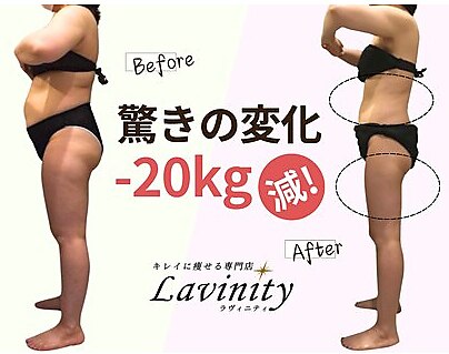 有名人多数利用！ダイエットや肌質改善に！ ラヴィニティ 自由が丘店(Lavinity)｜ホットペッパービューティー