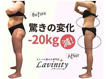 ラヴィニティ 自由が丘店(Lavinity)