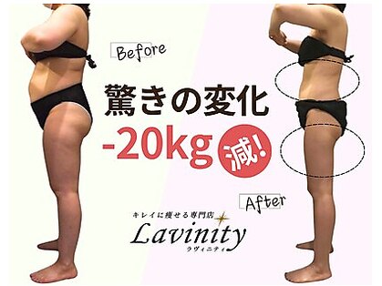 ラヴィニティ 自由が丘店(Lavinity)の写真