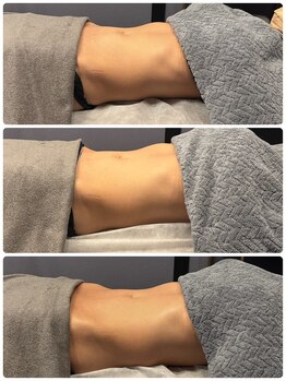 ロザリー(ROSALY)/腸もみＢ＆Ｆ