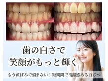 ビスマイル(Vismile)の雰囲気（最新機器で最先端のジェルで圧倒的な早さと結果を実感◎）