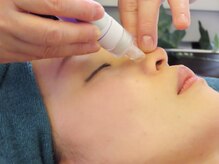 ルル 北仙台/ハイドラピーリング