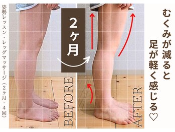 ミュカ(Miyuka)/むくみが減ると足が軽い！