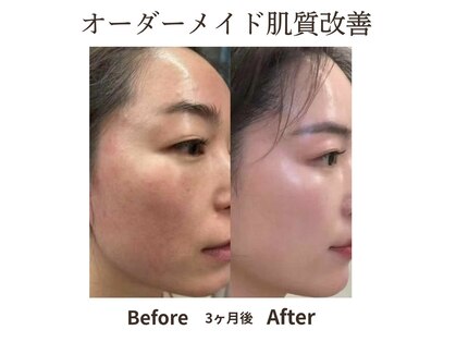 スターティス(STATICE)の写真