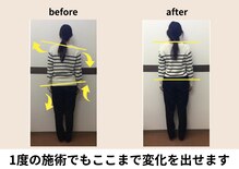 ゆずの木整体院