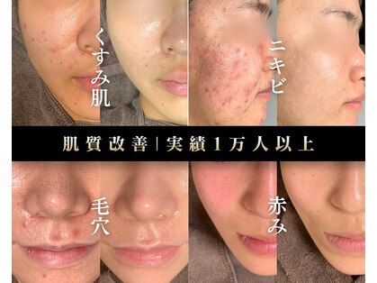 スリースリー 横浜(THREE THREE)の写真
