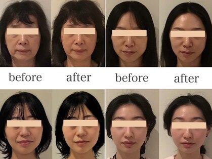 アミ(Amie)の写真