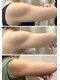 ページミューの写真/セルフケアでは痩せづらい二の腕や背中のハミ肉を撃退!老廃物の排出を促し、すっきりとしたシルエットへ♪
