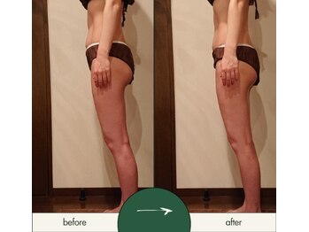 リラムーン(Relamoon)/バザルトボディ90分1回で♪