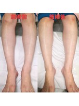 ドクターネイル爪革命 長野店/【トータルフットケア】/フット