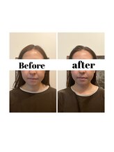 リモド(Rimodo509)/小顔矯正（ヘッドスパ