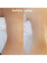 グレアージュ(GLEAGE)/