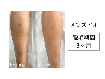 メンズビオ 神戸三宮店/