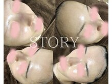 ストーリー 岐阜店(STORY)/ハーブピーリング専門店STORY