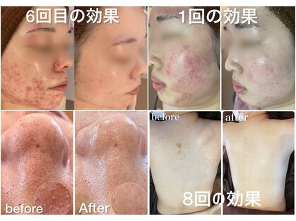 エヌエースキン 川崎店(NAskin)の写真