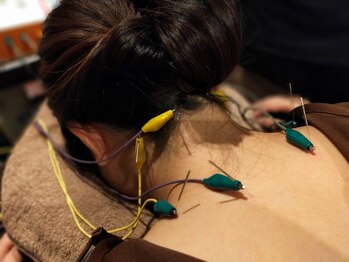 灸スタイル 掛川本院(灸Style)の写真/結果重視の方へ!頭痛・肩のコリには当院の鍼灸ケアでお悩みを徹底解消◎施術後の軽さと変化に驚き!